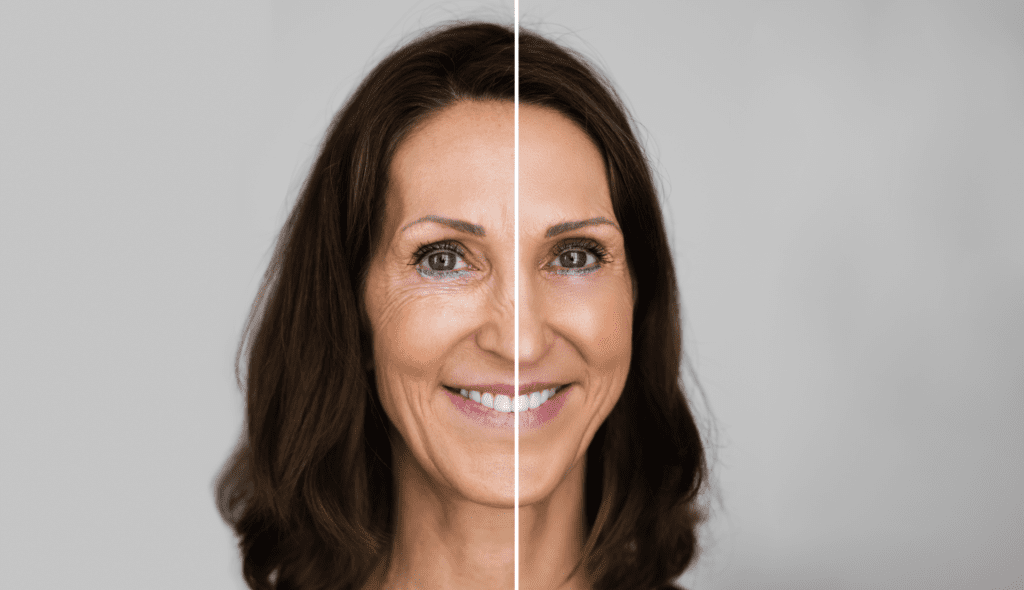 DMAE and its benefits