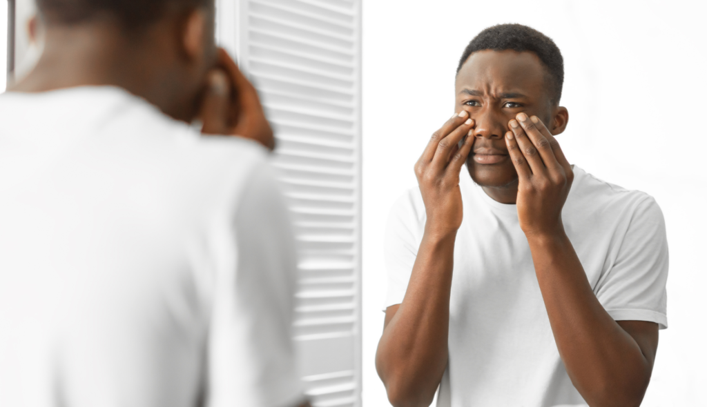 How to Get Rid of Bags Under Eyes