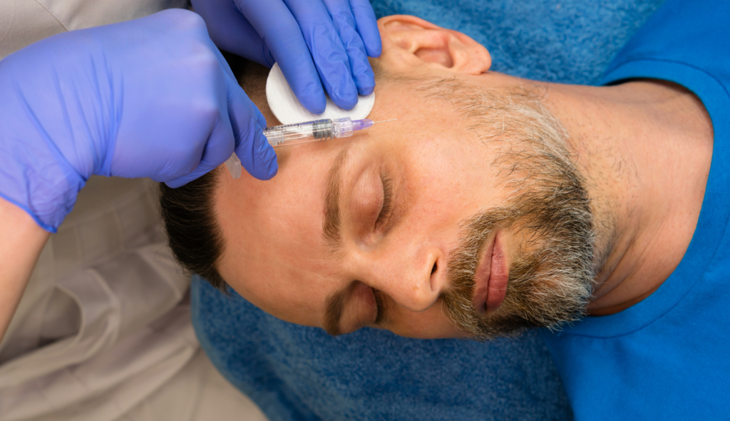 Mesotherapy and Hyaluronic Acid: A Winning Combination