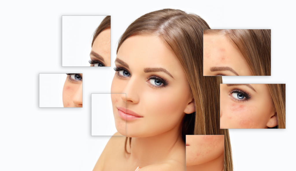 Scar Mark Prevention