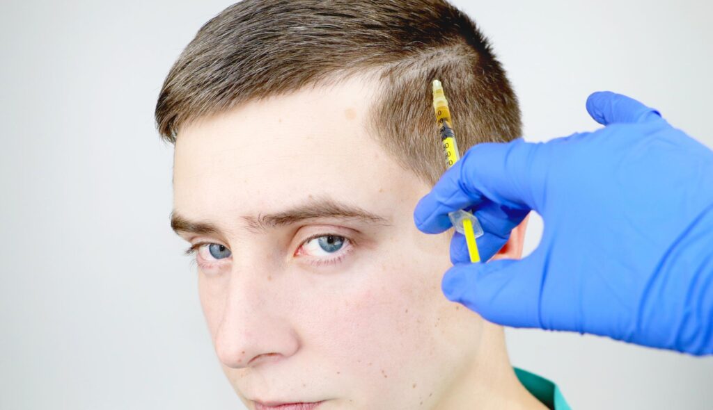 Mesotherapy for Hair Loss: Revitalize Your Locks Naturally