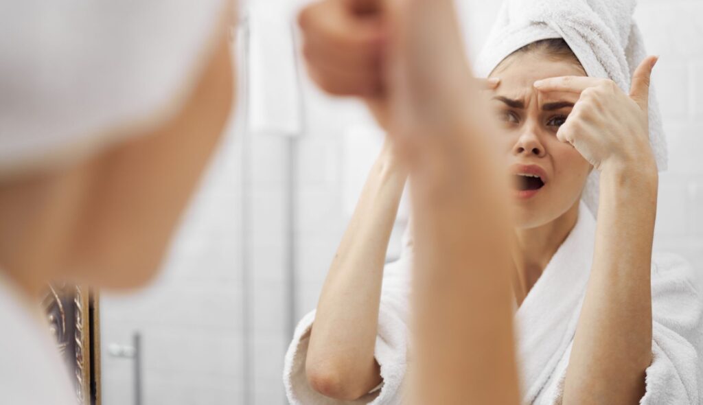 Mapping Out Acne: A Comprehensive Guide to Understanding and Treating Facial Breakouts