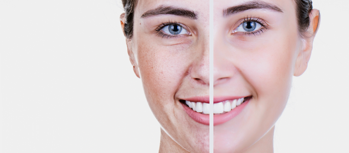 Anti-aging serum benefits