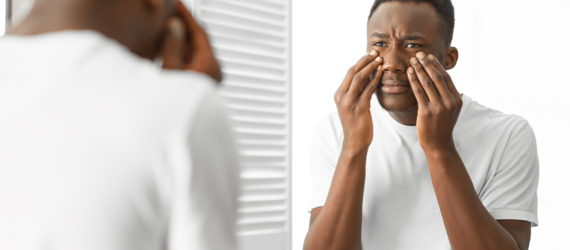 How to Get Rid of Bags Under Eyes