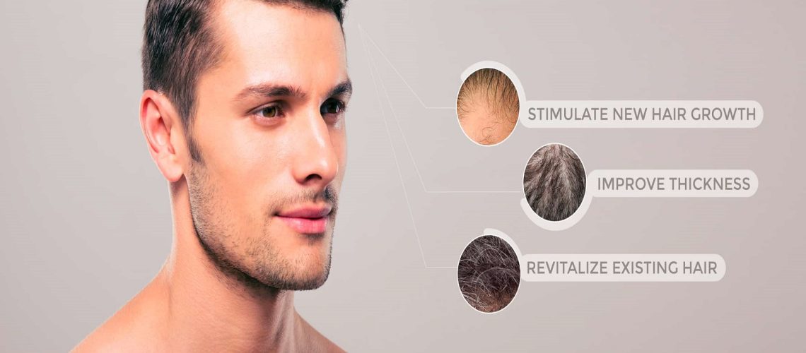 Unraveling Alopecia Areata: Understanding Causes, Symptoms, and Treatment