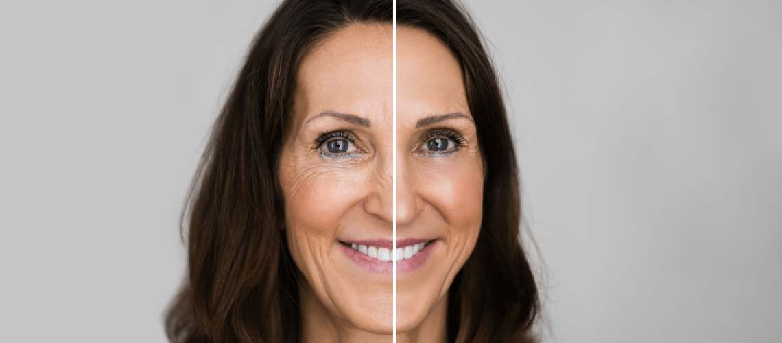 DMAE and its benefits