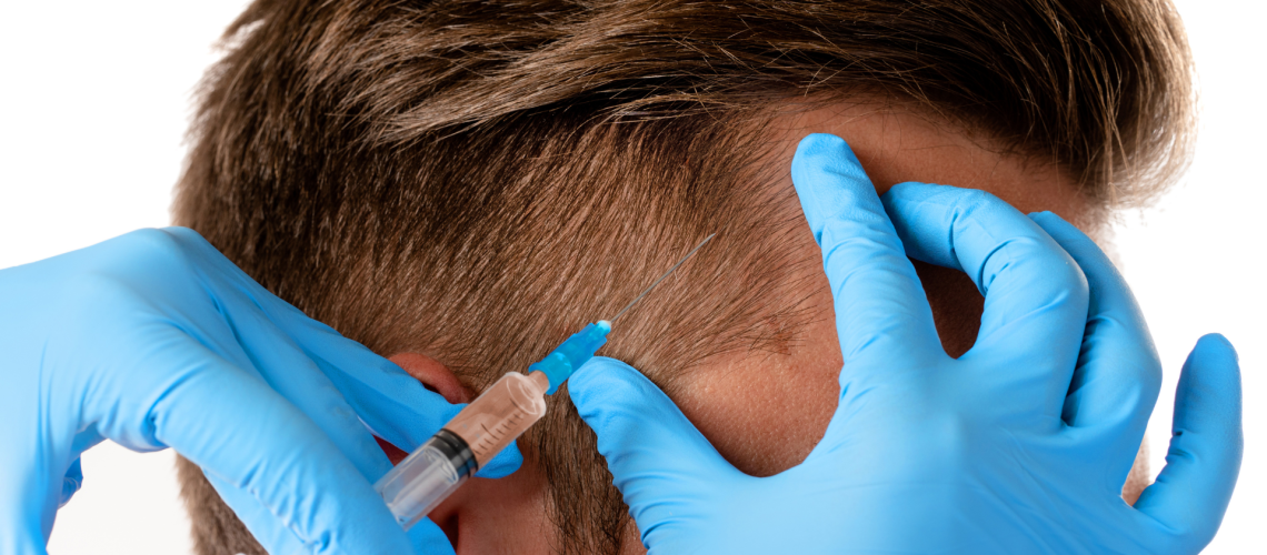 How much Mesotherapy for hair is effective?