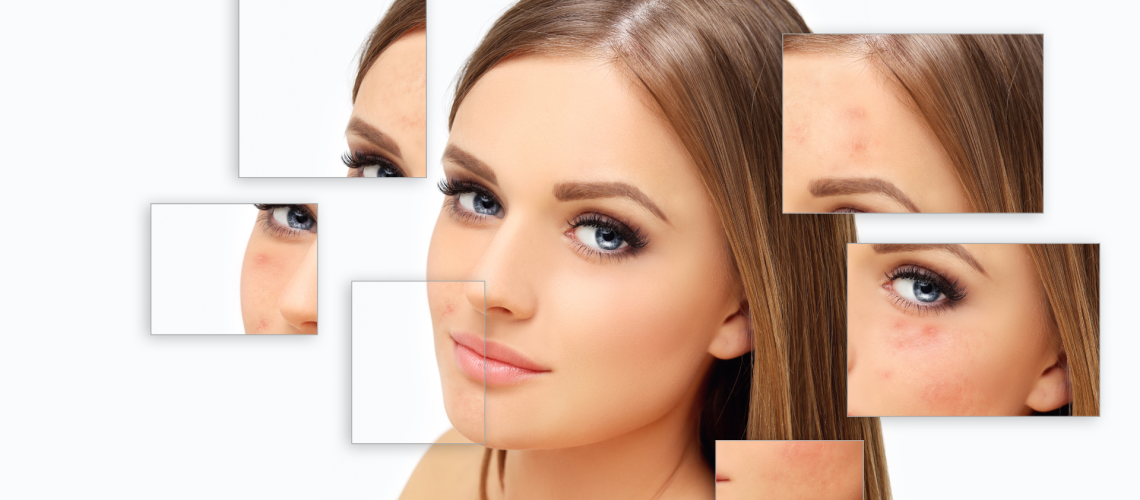 Scar Mark Prevention