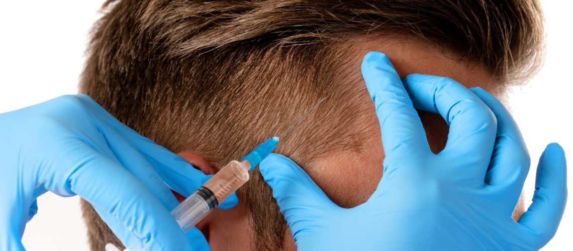 DIY Hair Mesotherapy