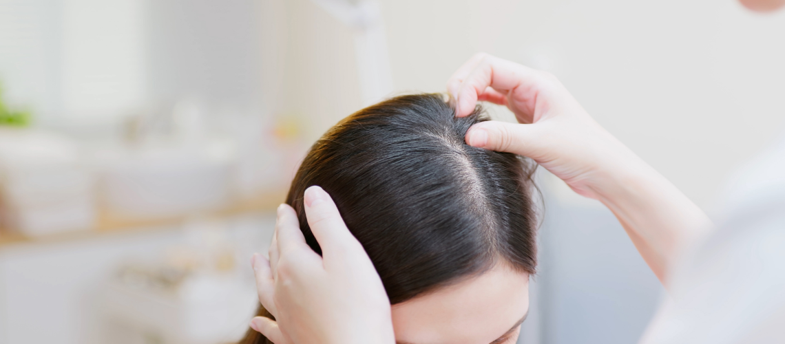 Striking the Balance: Tips to Prevent Oily Hair and Maintain a Healthy Scalp